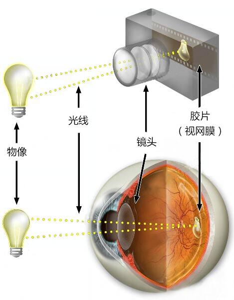 最新視力矯正技術介紹與突破