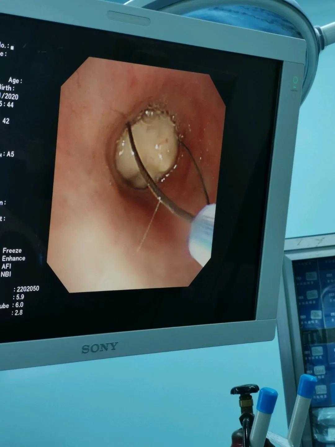 電子鼻咽喉鏡價(jià)格的市場(chǎng)定位分析，多元因素下的市場(chǎng)趨勢(shì)探討